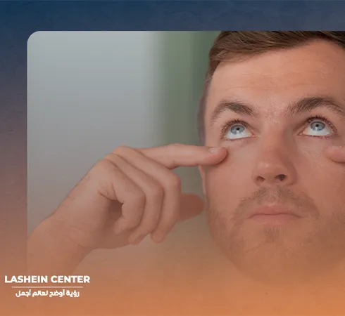 When does vision stabilize after cataract surgery?