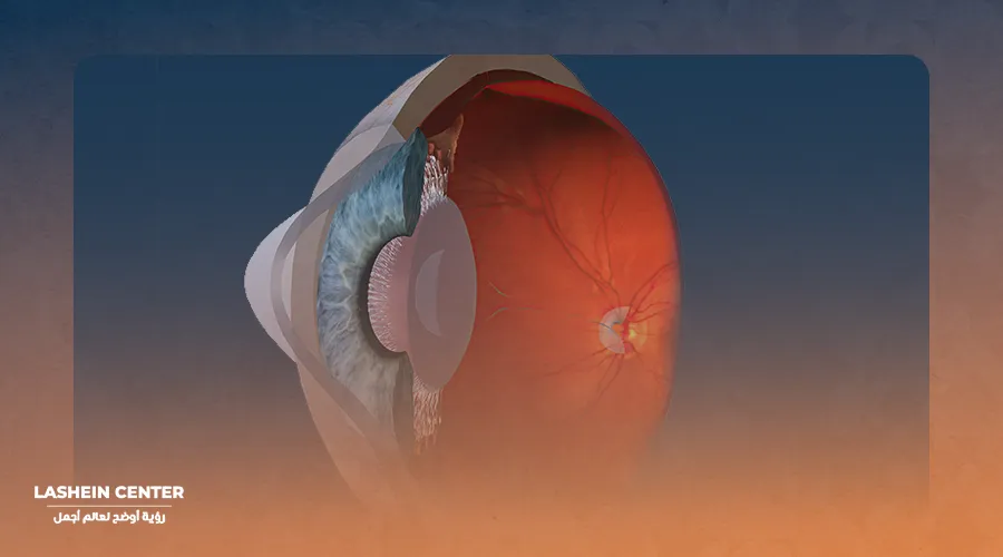 Causes of eye effusion