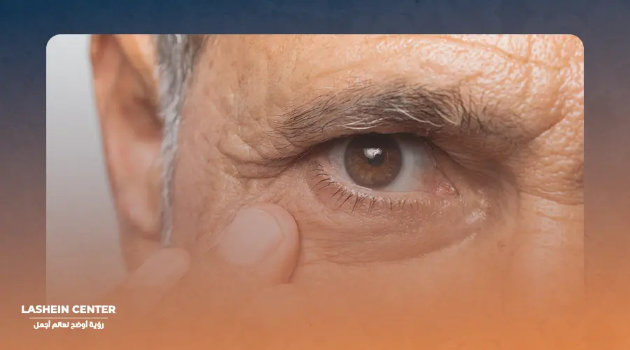 Success rate of cataract surgery