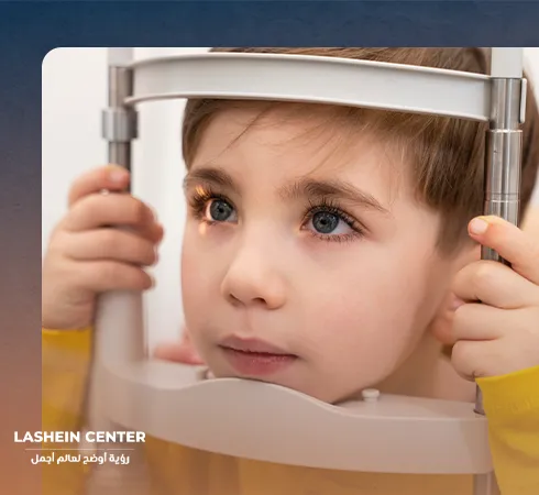 عملية حول العين عند الاطفال